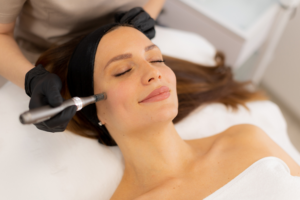 Does Microneedling Help Acne Scars, Large Pores, and Wrinkles