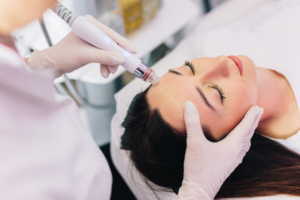 Can You Get a HydraFacial if You Have Acne