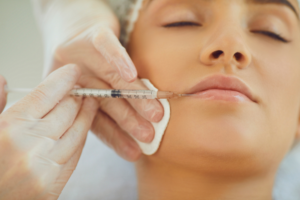What Should You Know Before Getting Lip Filler for the First Time